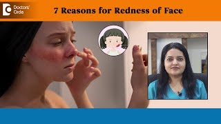 7 Reasons for Redness of Face Erythema Sunburn Rosacea  Dr Urmila Nischal  Doctors Circle [upl. by Elleinod]