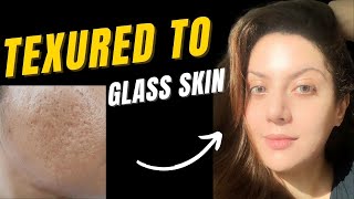 How to treat textured skin  Bumpy skin texture I Closed comedones treatment  Pitted scar treatment [upl. by Ahtnamas]