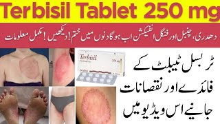 Terbisil Tablet 250mg  Terbinafine Tablet Best Medicine For Fungal Infection  Side Effects  Uses [upl. by Kerat155]