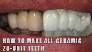 How to make AllCeramic 28Unit Teeth [upl. by Deeann897]