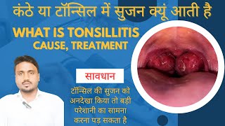 What Is Tonsillitis Cause Treatment tonsillitis tonsils tonsilstones imk [upl. by Nnylram605]