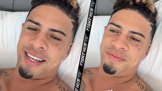 SAD AUSTIN MCBROOM FIRST WORDS AFTER KO LOSS TO ANESONGIB SHOWS OFF BRUISES amp GIVES GIB RESPECT [upl. by Rue789]