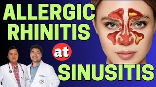 Allergic Rhinitis at Sinusitis  Payo ni Doc Gim Dimaguila ENT Doctor at Doc Willie Ong [upl. by Daryn]