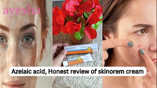 How to Use Azelaic Acid 20 benefits of azelaic acid Skinoren Cream Review in Pakistan [upl. by Enrobialc]