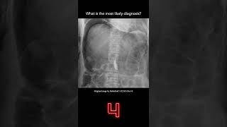 Abdominal Xray Question 1 [upl. by Corell]