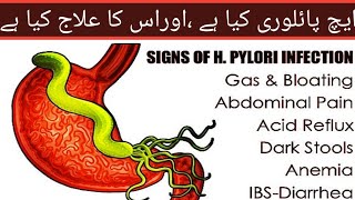 Helicobacter Pylori Infection Causes Signs and Symptoms Diagnosis and Treatment [upl. by Aleit306]