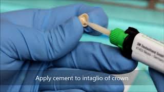 Bonding a zirconia crown [upl. by Gallager]