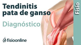 Cómo saber si tengo tendinitis de la pata de ganso [upl. by Ennaear]