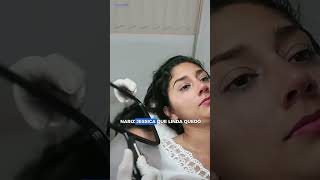 Mejora tu nariz sin cirugía y en minutos 🤩 rinomodelacion belleza cirugiadenariz rinoplastia [upl. by Nerrot]