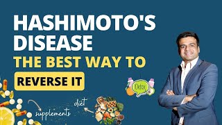 What is Hashimotos Disease Symptoms of Hashimotos  The Best way to Reverse Hashimotos Disease [upl. by Skyler]