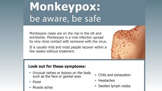 Monkeypox Virus safetytalk [upl. by Lemraj831]