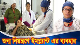 দীর্ঘমেয়াদী ইমপ্ল্যান্ট পদ্ধতি নিন  জন্মনিয়ন্ত্রণে ইমপ্ল্যান্ট  Implant Tips  Doctor Mission [upl. by Ayam]