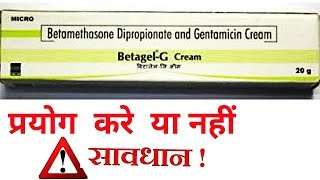 Betagel G Cream Full Review in Hindi [upl. by Cortney]