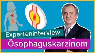 Diagnose Speiseröhrenkrebs – wie geht es weiter  Asklepios [upl. by Enobe881]