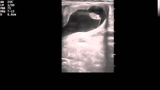 Ultrasound of a 27 day equine pregnancy [upl. by Farmelo]