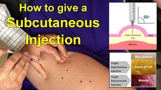 How to Give a Subcutaneous Injection Video [upl. by Melisandra]