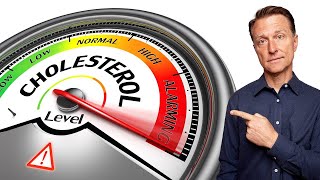 1 Top Remedy to Lower and Regulate Cholesterol [upl. by Cyprio669]