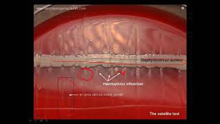 Satellitism test [upl. by Goldberg]