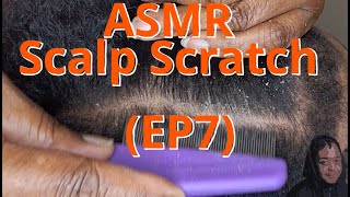 ASMR Scalp Scratch EP7  itchchronicles [upl. by Arbua]