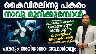 കൈവിരലിനു പകരം നാവു മുറിക്കുമ്പോൾപലരും അറിയാത്ത യാഥാർത്ഥ്യം  AcuMasterShuhaib Riyaloo [upl. by Hourihan688]