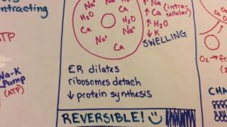 Ischemic Reperfusion Injury [upl. by Ebony304]