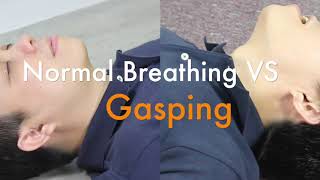 Sudden Cardiac Arrest SCA and Agonal Breathing Gasping [upl. by Heyde220]