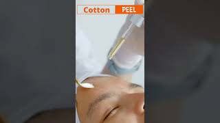 Chemical Peel  Cotton Peel  DTCSKINCLINIC [upl. by Trici]