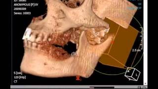 3D Module Segmentation Method A [upl. by Clemmy996]