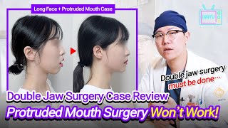 ENJPTH SUB Korean Double Jaw Surgery Case Review Long Face  Protruded Mouth [upl. by Airliah]