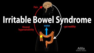 Irritable Bowel Syndrome Pathophysiology Symptoms Causes Diagnosis and Treatment Animation [upl. by Wehttam414]