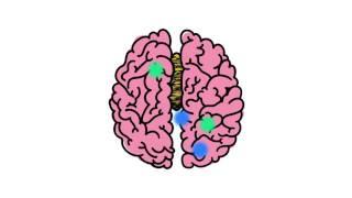 Understanding Disorders of the Corpus Callosum Animated Video by NODCC [upl. by Shaddock]