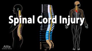 Spinal Cord Injury Animation [upl. by Shanon]