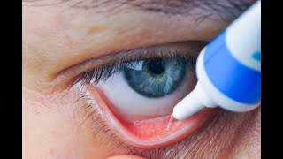 How do you use erythromycin ointment for a stye [upl. by Alemat]