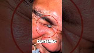 ticks  funny eyes didyouknow memes trending [upl. by Hyams]