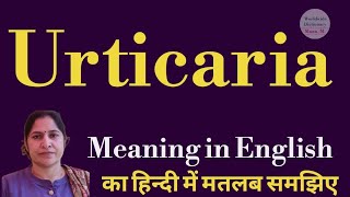 urticaria meaning l meaning of urticaria l urticaria ka matlab Hindi mein kya hota hai l vocabulary [upl. by Aliban]