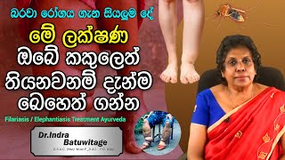 Filariasis Sinhala Lymphatic filariasis  කකුලක් ඉදිමීම ඇග කැසීම බරවා රෝගයේ ලක්ෂණයක් විය හැකියි [upl. by Ennairb]