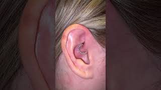 How to get rid of a piercing bump piercing piercingbump keloid [upl. by God]