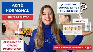 ACNÉ HORMONAL 2022 ¿SIRVE LA DIETA  SÍNDROME DE OVARIO POLIQUÍSTICO TRATAMIENTO  INOSITOL [upl. by Larue]