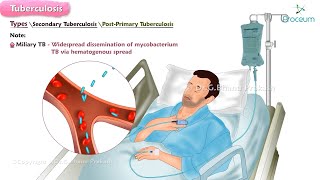 Tuberculosis🫁🦠  Microbiology  Clinical features  Diagnosis  Treatment [upl. by Krutz]