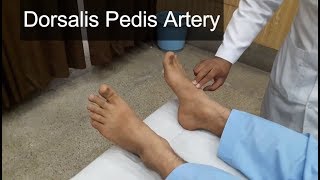 Dorsalis Pedis Artery Clinical Examination [upl. by Kalfas]