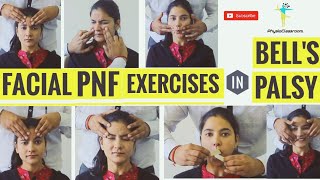 FACIAL PNF EXERCISES IN BELLS PALSY [upl. by Deonne]