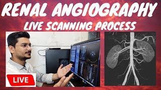 CT RENAL ANGIOGRAPHY LIVE SCAN  Live ct scan of renalabdominal Angiography radiologytechnologist [upl. by Michaelina]