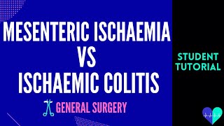 Mesenteric Ischaemia vs Ischaemic Colitis  Medical Tutorial [upl. by Biernat232]