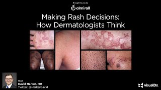 Making Rash Decisions How Dermatologists Think  Dr David Harker [upl. by Torrin]