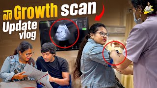 నా Growth Scan Update Vlog  Yadammaraju  StellaRaj 777 [upl. by Aniela40]