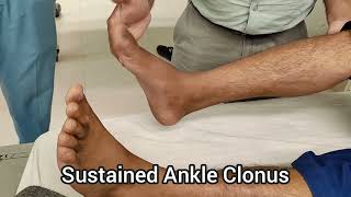 How to Elicit Ankle Clonus [upl. by Llenrac]