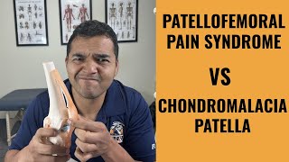 Chondromalacia Patella vs Patellofemoral Pain Syndrome [upl. by Aket]