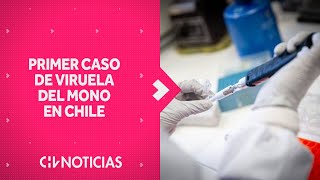 Confirman PRIMER CASO de Viruela del Mono en Chile  CHV Noticias [upl. by Ansela]