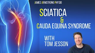 Understanding Sciatica and Cauda Equina Syndrome with Tom Jesson [upl. by Schubert879]