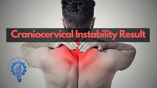 Craniocervical instability CCI Rehab Journey with Coach Chong  Hyperarch Fascia Training [upl. by Elletnohs794]